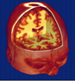 Reconstrucci�n tridimensional de un cerebro