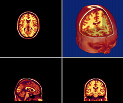 [ 3dcerebrocolor2.jpg ] (43273 bytes)