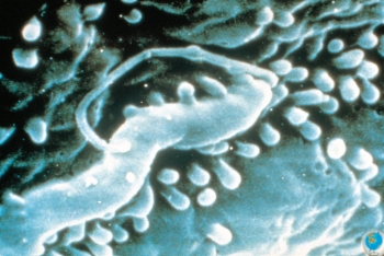 Azprensa. Fotograf�a electr�nica del Helicobacter 