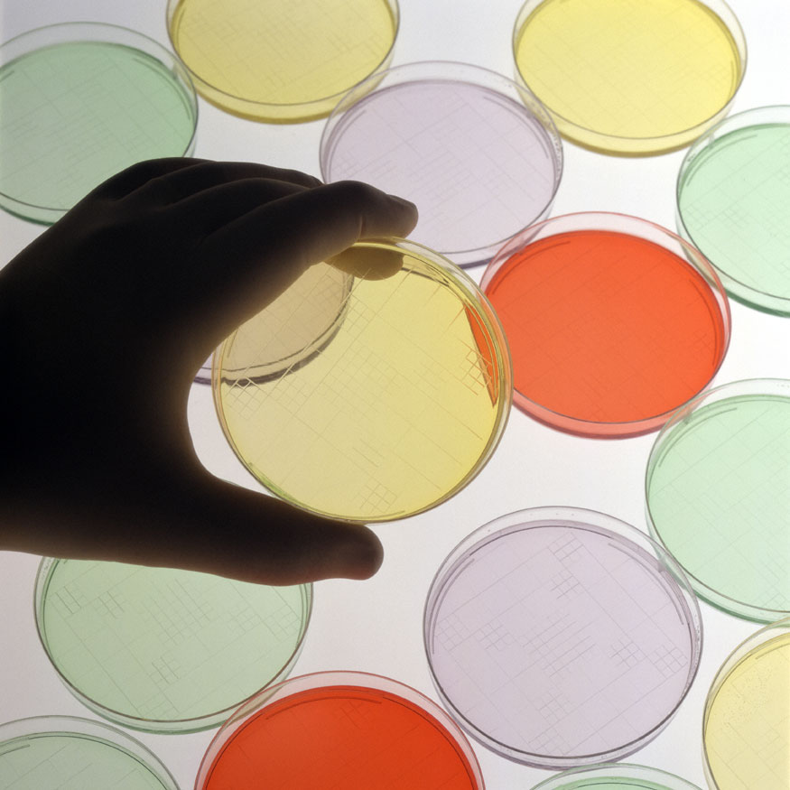 mano sujetando diferentes cultivos bacterianos