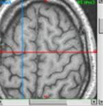 [ cerebrormn.jpg ] (25490 bytes)