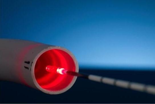 [ laserradial.JPG ] (12175 bytes)